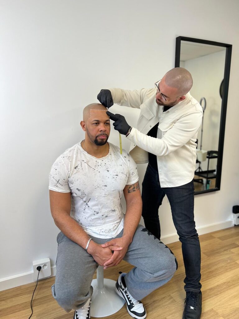 traçage ligne frontale tricopigmentation