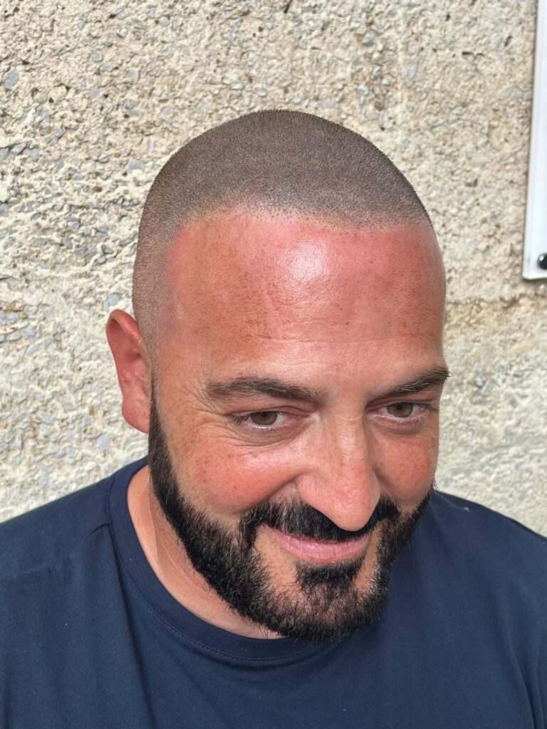 effet naturel tricopigmentation
